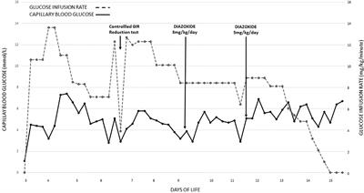 Case Report: Neurodevelopmental Outcome in a Small-for-Gestational-Age Infant With Symptomatic Hyperinsulinemic Hypoglycemia, Gaze Preference, and Infantile Spasms